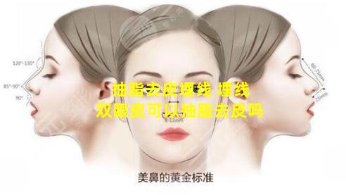 抽脂去皮埋线 埋线双眼皮可以抽脂去皮吗